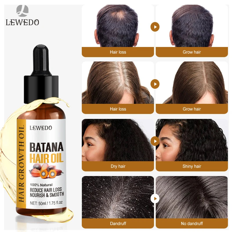 Batana Hair Growth Oil
