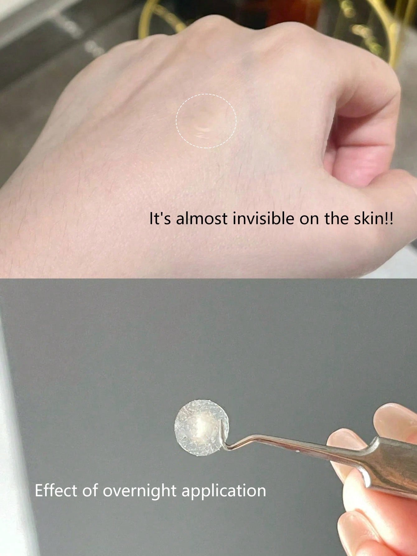 Olive Young Care Plus Spot Patch