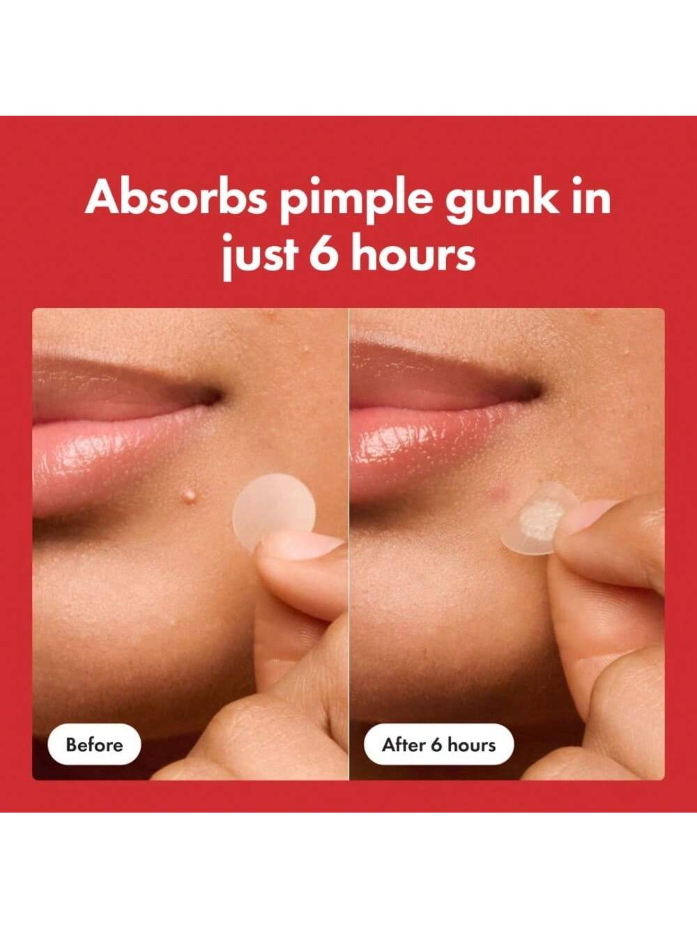 Mighty Patch Hero Cosmetics Original Patch