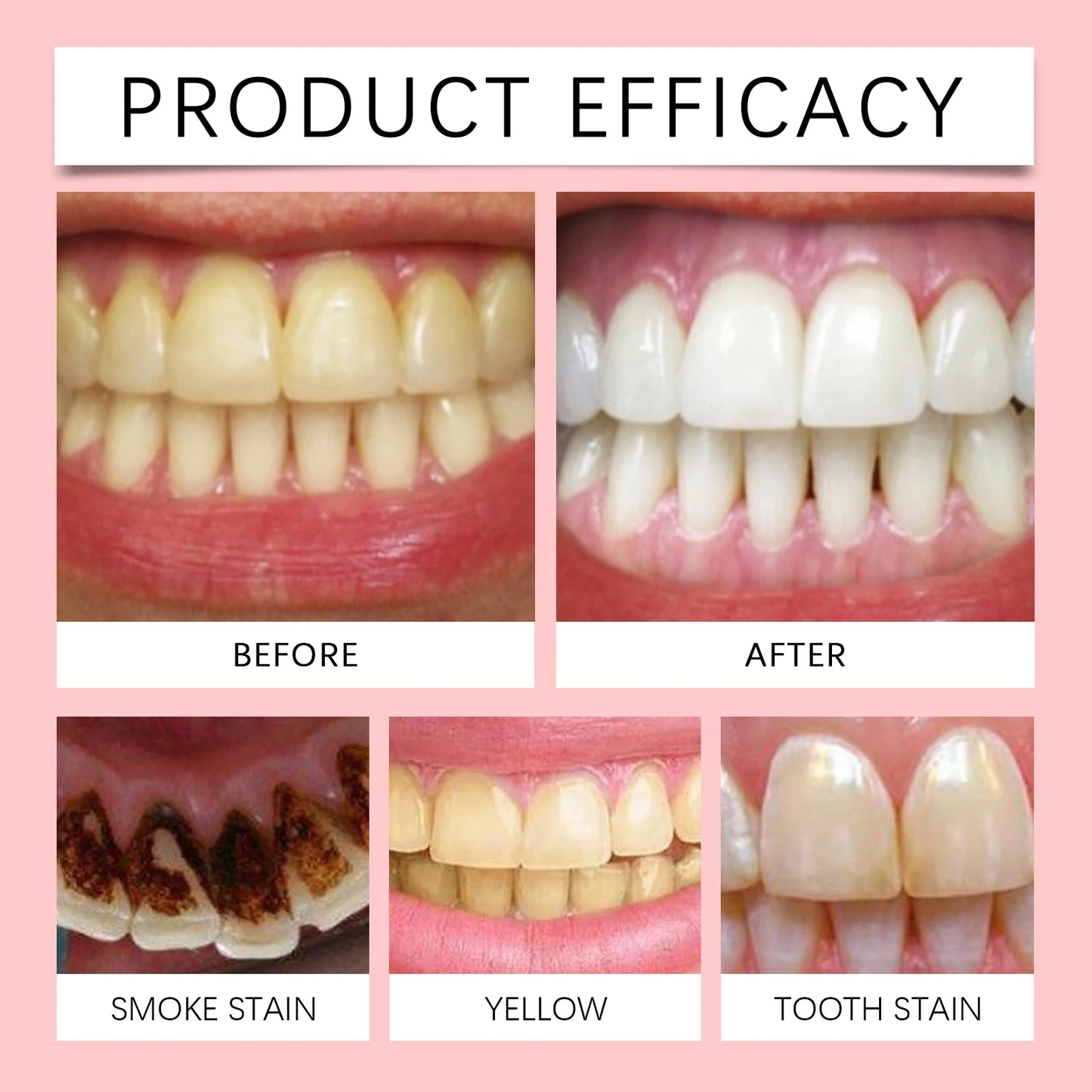 SP6 Probiotic Whitening Toothpaste